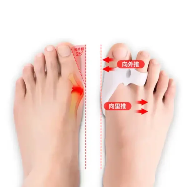 Soft Silicone Toe Separator